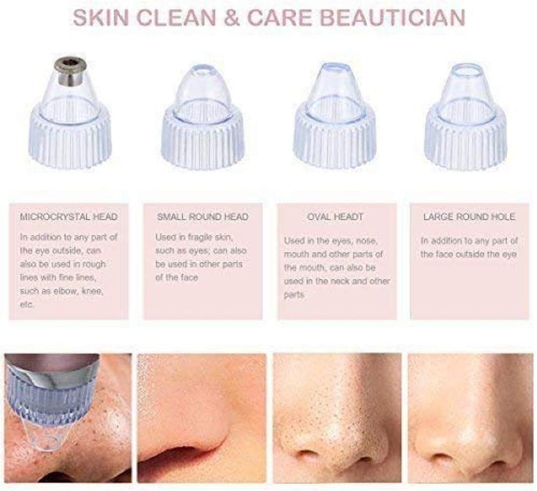 💆♀️ Pore Cleaning Device ✨ | Blackhead Remover Vacuum 🔋 USB Rechargeable 🌟