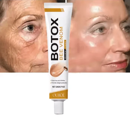 OUHOE Bee Venom Botox Cream: Erase Wrinkles & Get Youthful, Radiant Skin Naturally