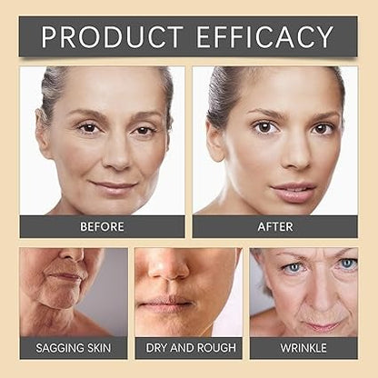 OUHOE Bee Venom Botox Cream: Erase Wrinkles & Get Youthful, Radiant Skin Naturally